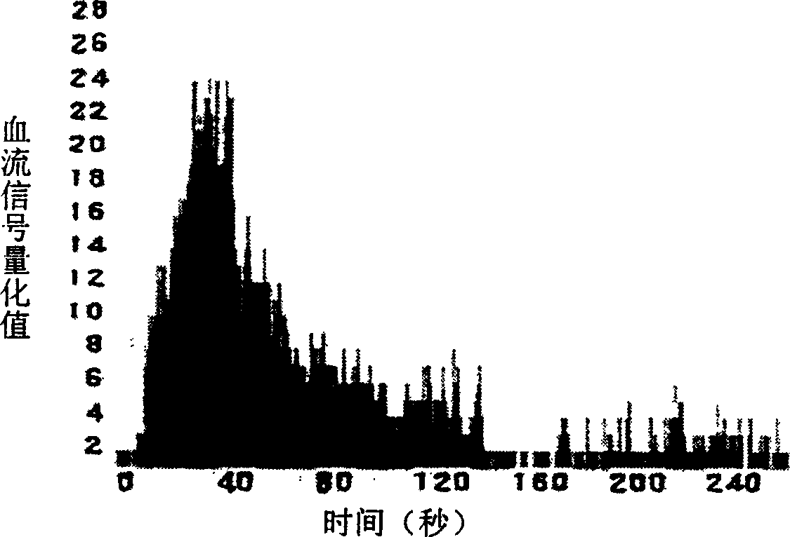 Ultrasonic contrast medium and its preparing process