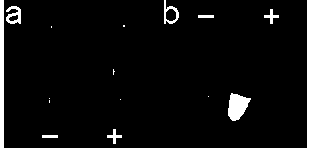 Method for detecting three kinds of urogenital canal mycoplasma by loop-mediated isothermal amplification technology