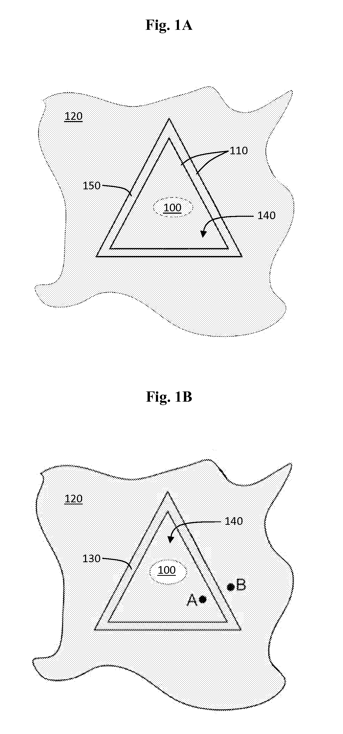 Method for Decreasing the Size and/or Changing the Shape of Pelvic Tissues