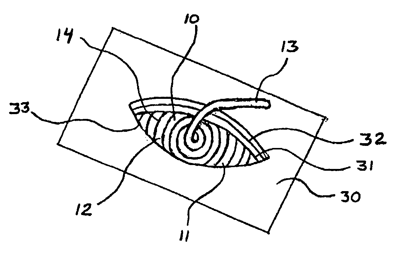 Viscera retainers, surgical drains and methods for using same