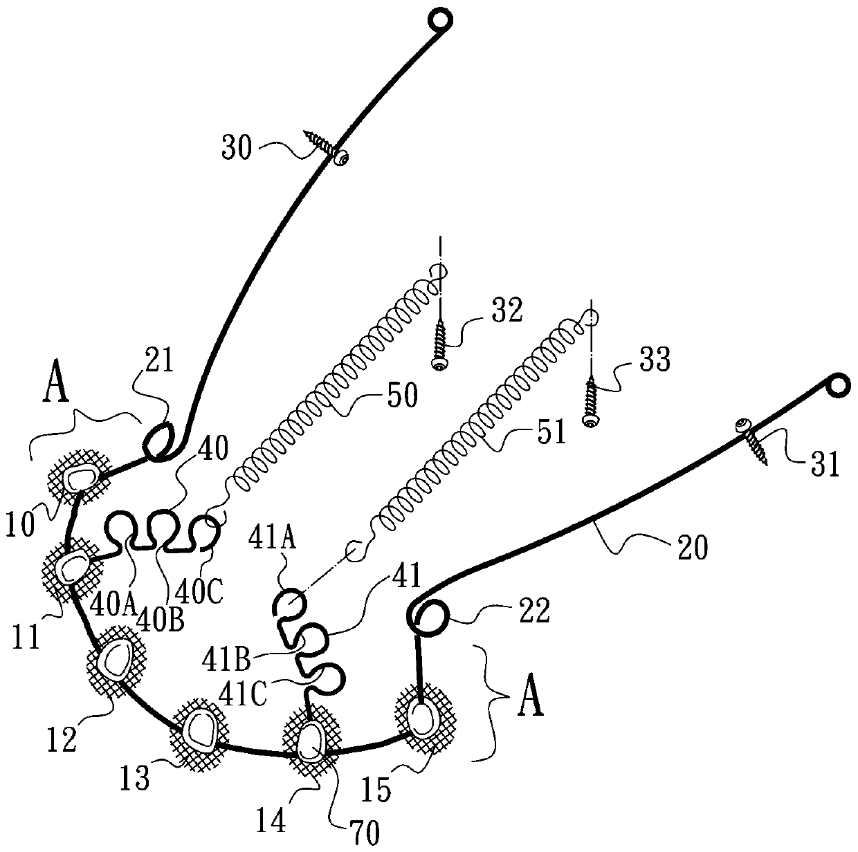 Lingual anterior teeth retractor