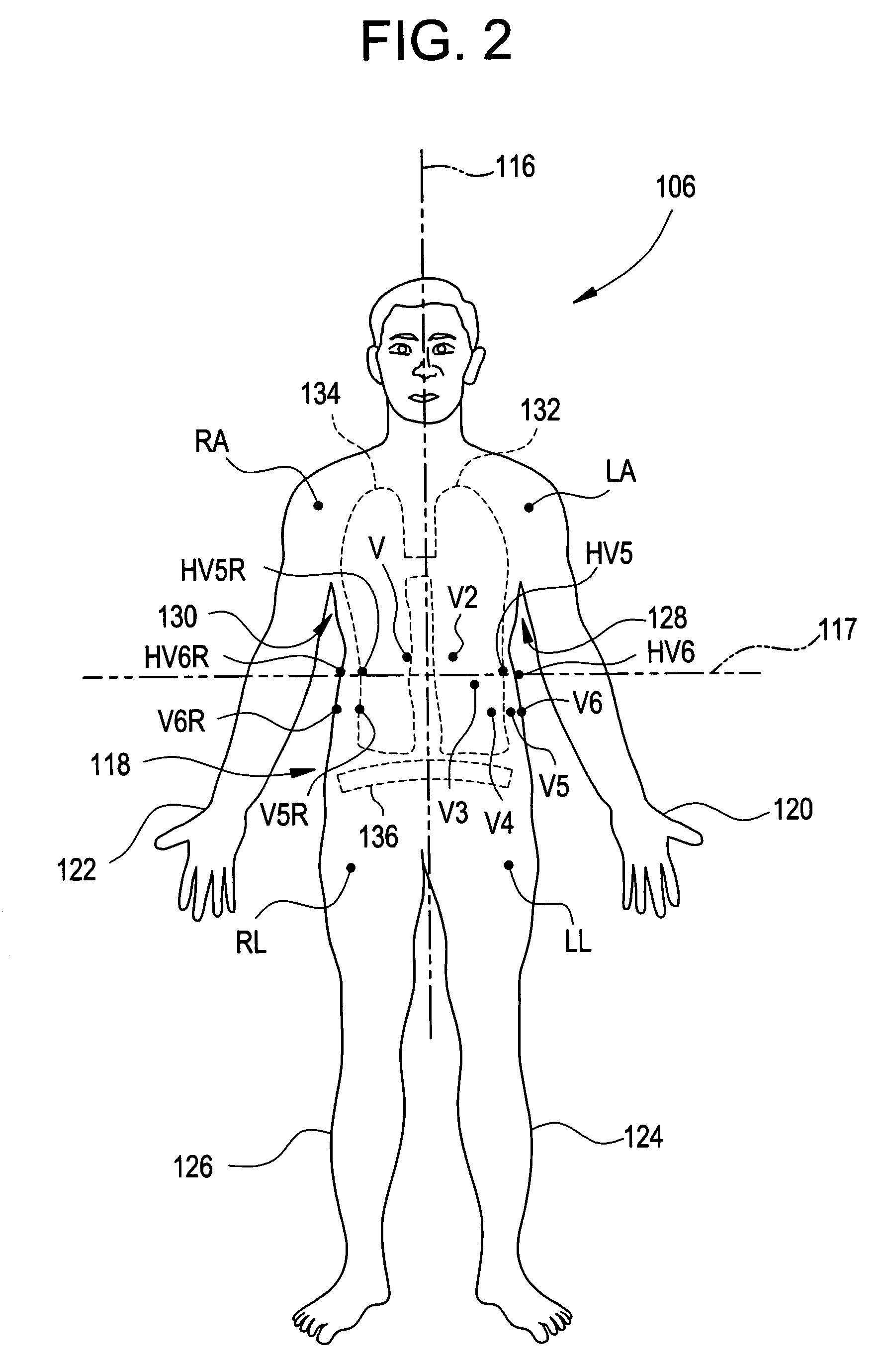 Respiration monitoring system and method