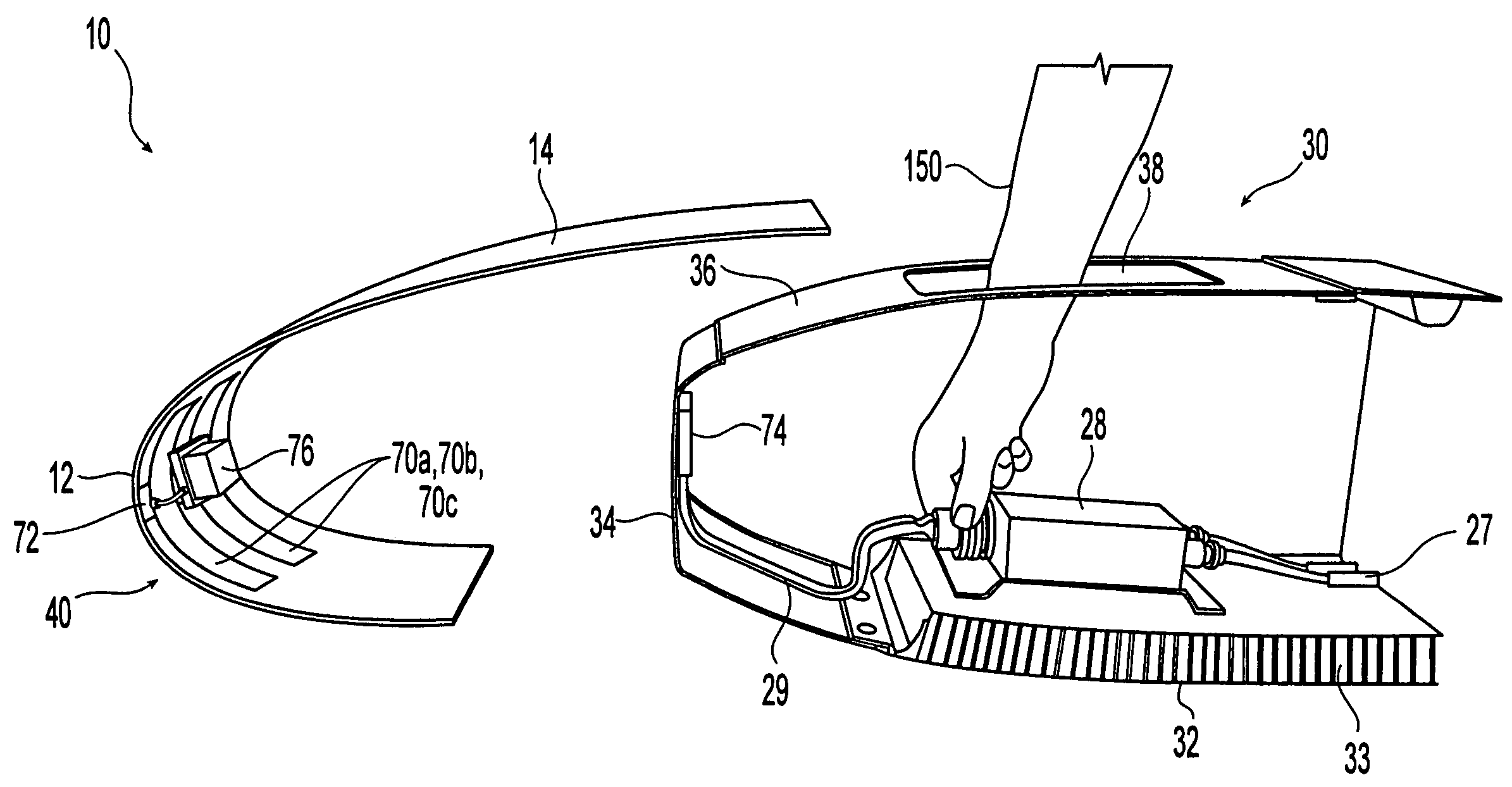 Aircraft engine nacelle inlet having electrical ice protection system