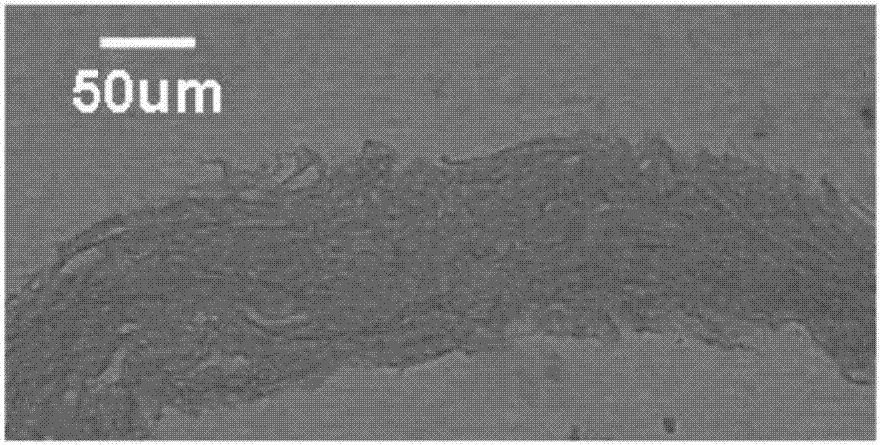 Acellular cornea stroma lens and preparation method thereof