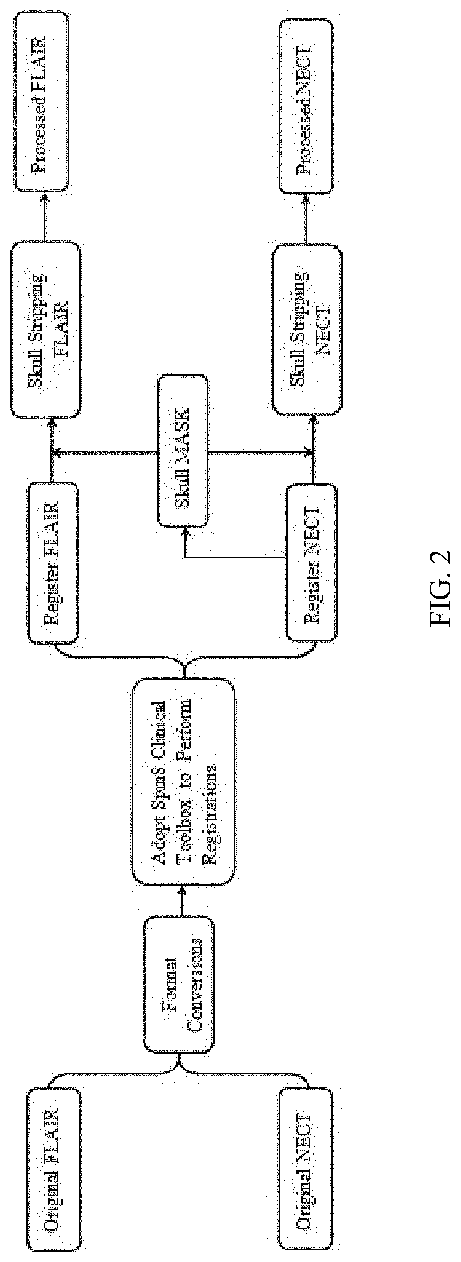 An Auxiliary Diagnostic Model and an Image Processing Method for Detecting Acute Ischemic Stroke