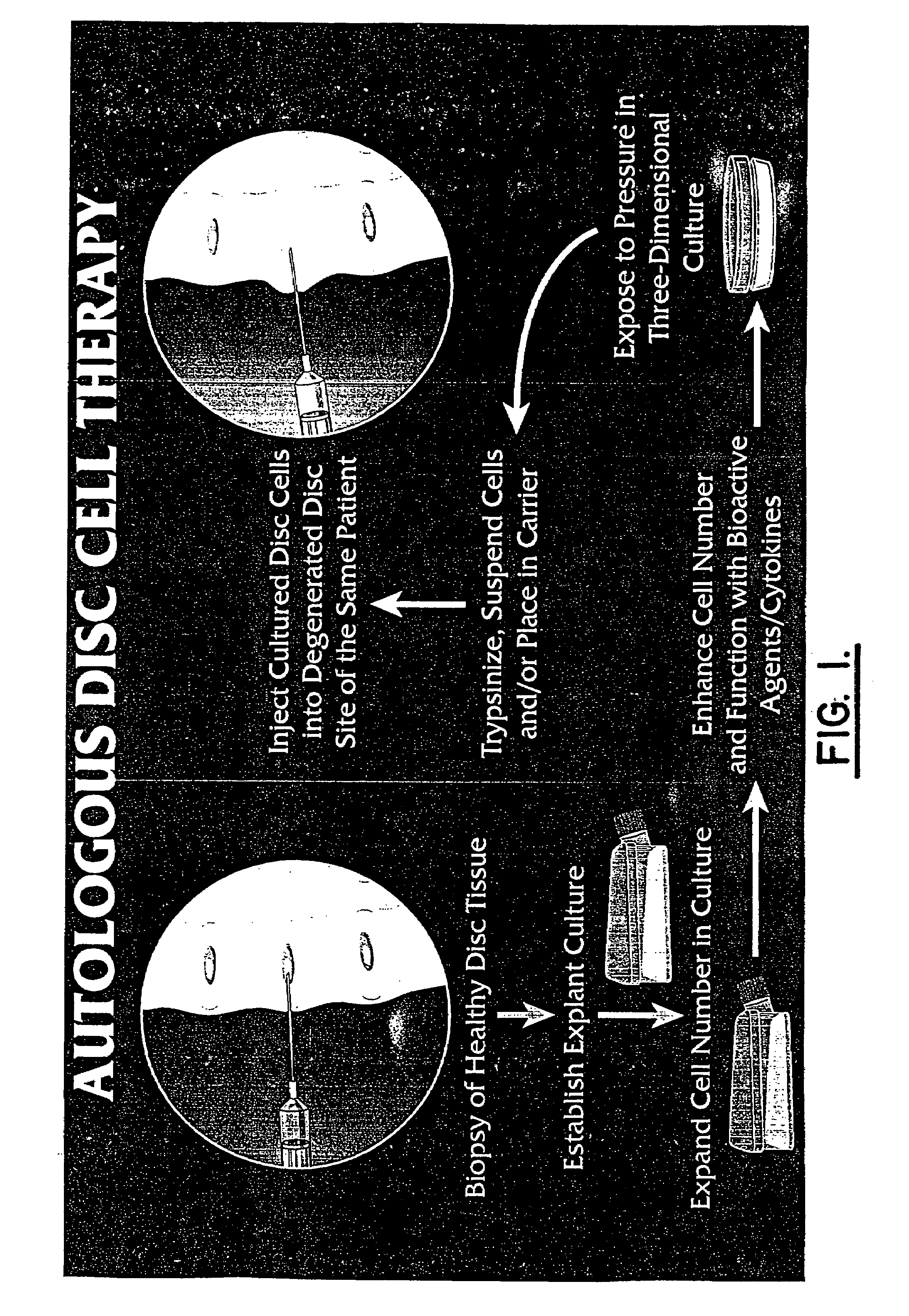 Method for producing human intervertebral disc cells for implantation