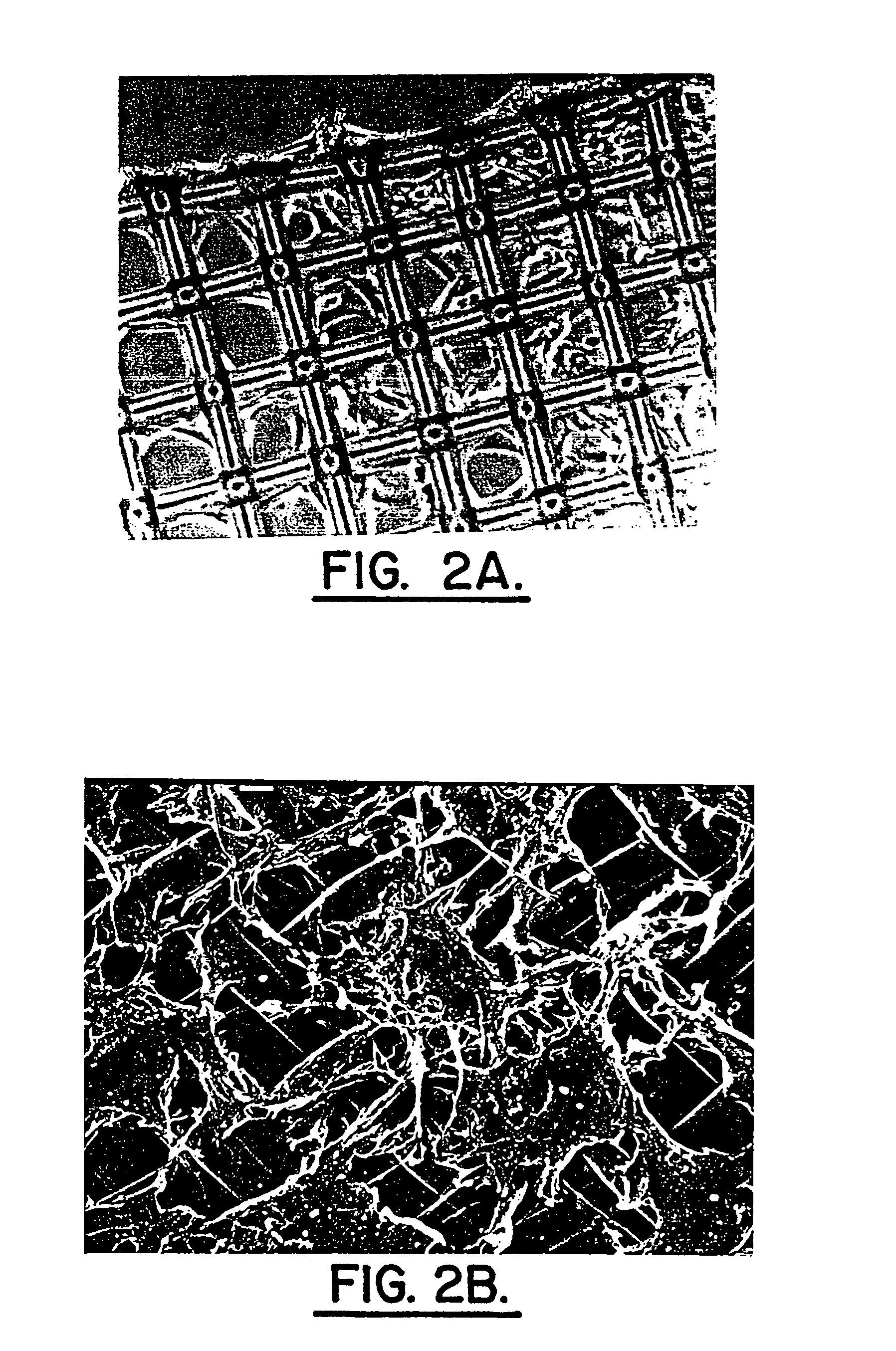 Method for producing human intervertebral disc cells for implantation