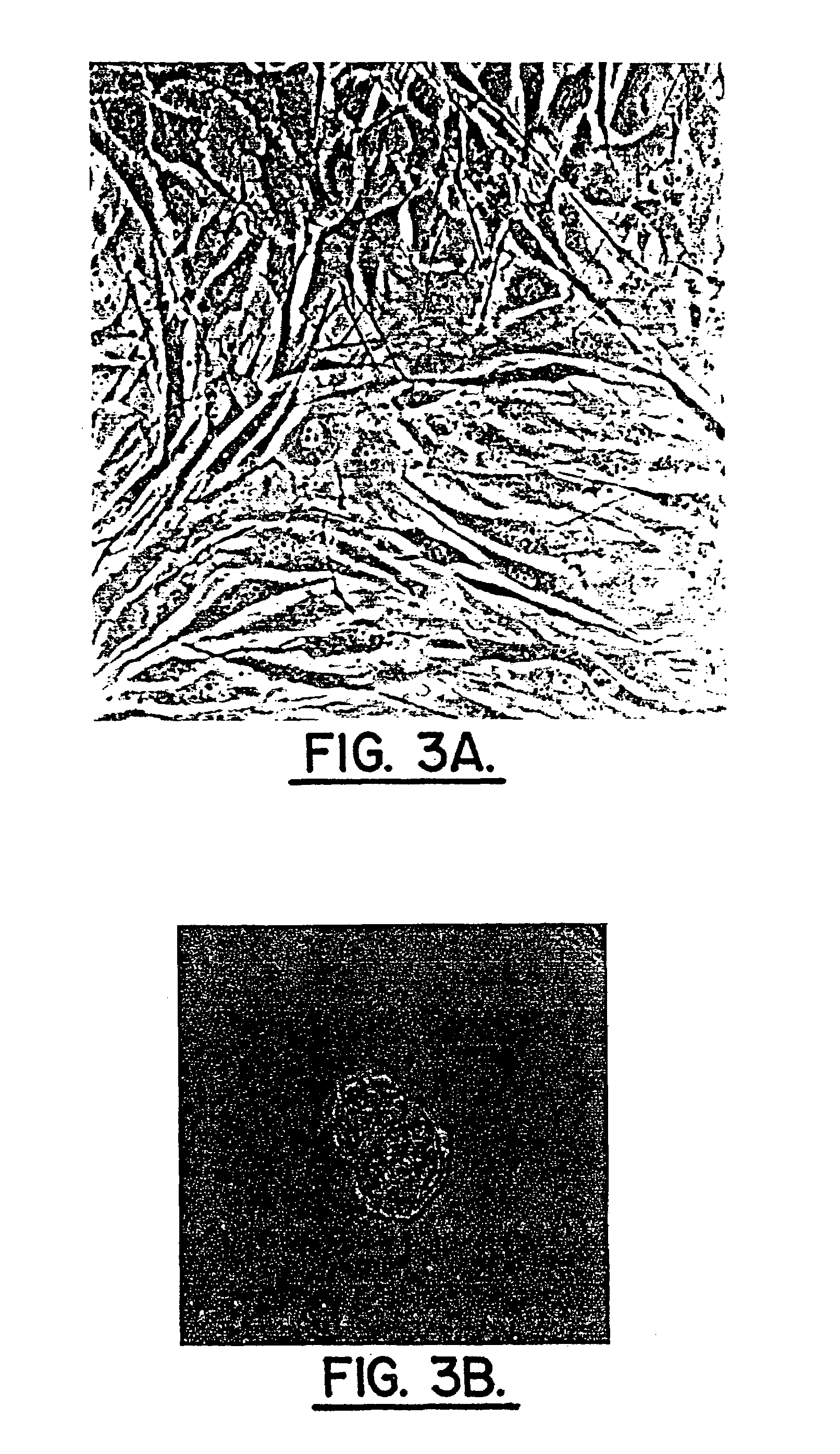 Method for producing human intervertebral disc cells for implantation