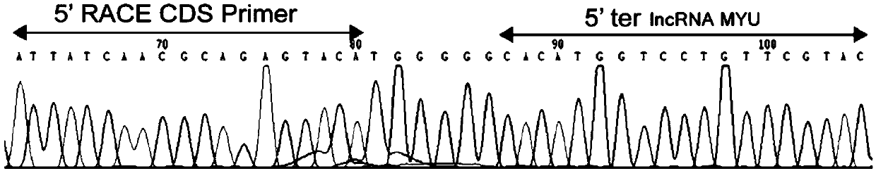 Long-chain non-coding RNA for early diagnosis of human prostate cancer and its preparation and use