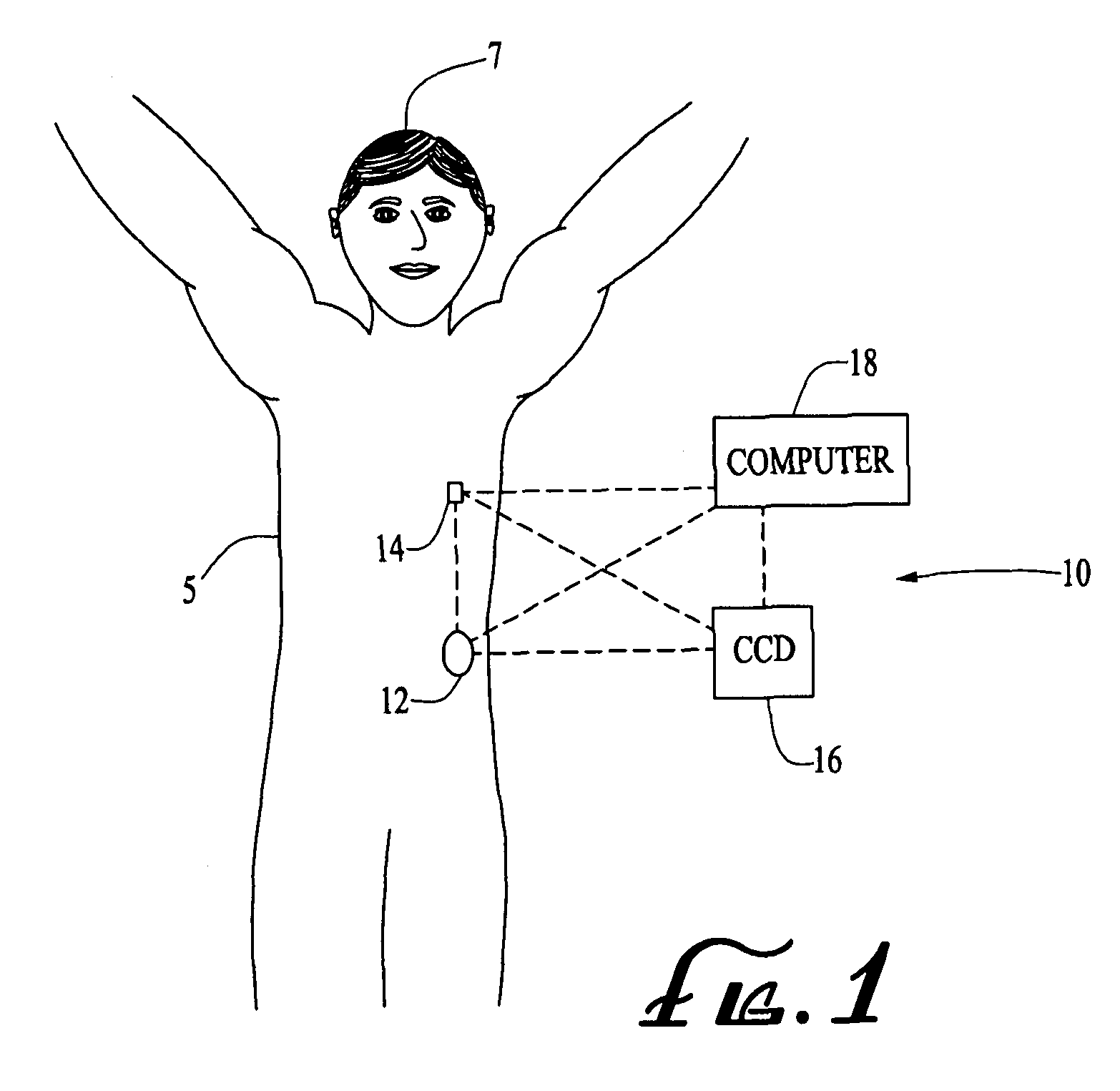 Systems and methods allowing for reservoir filling and infusion medium delivery