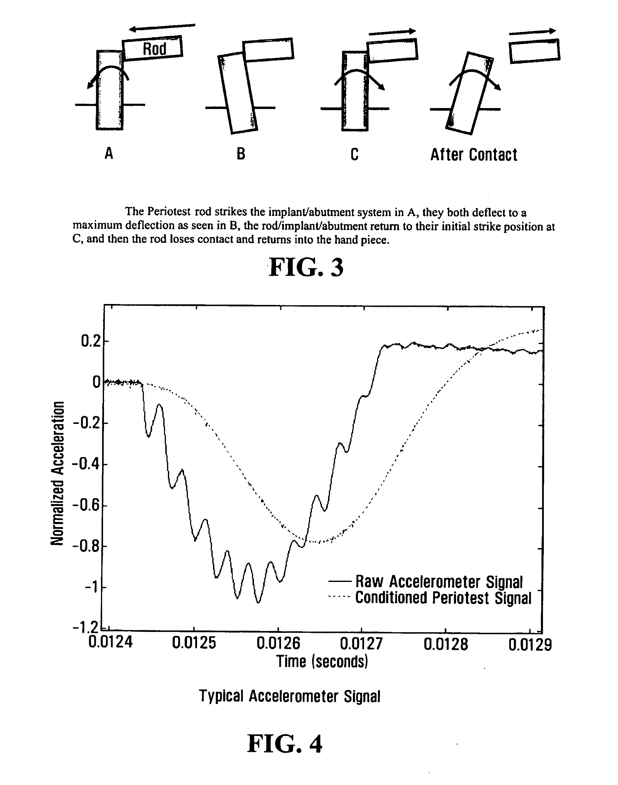 Apparatus and method for assessing percutaneous implant integrity