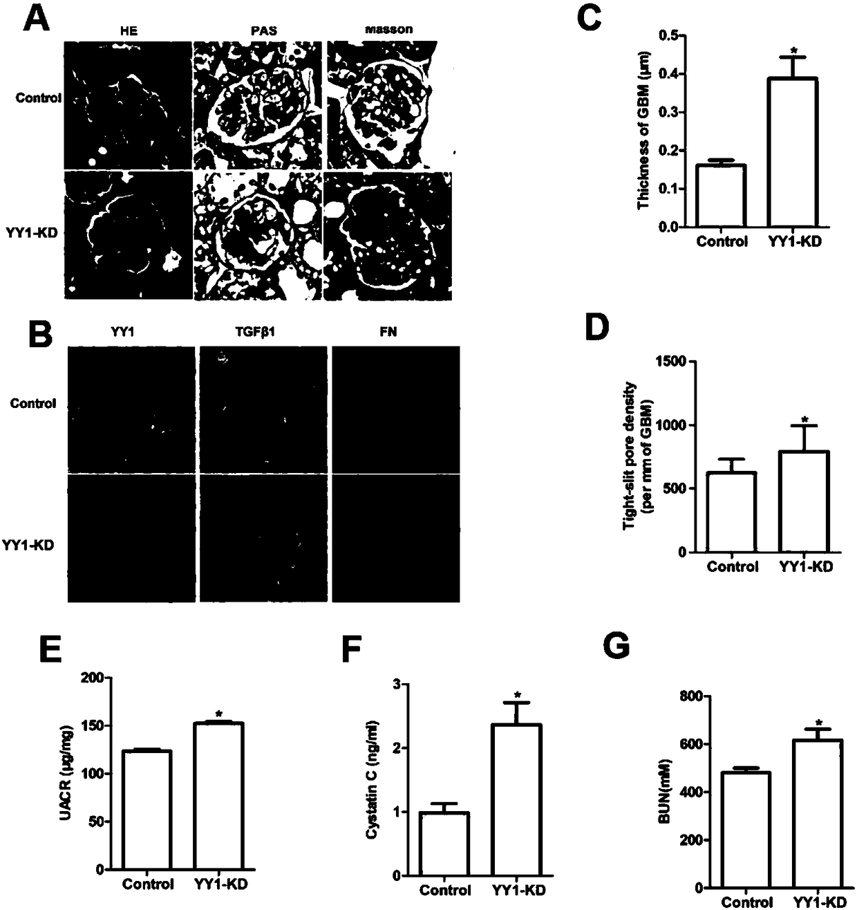 Application of Eudesmin in preparation of drugs for preventing or curing renal fibrosis