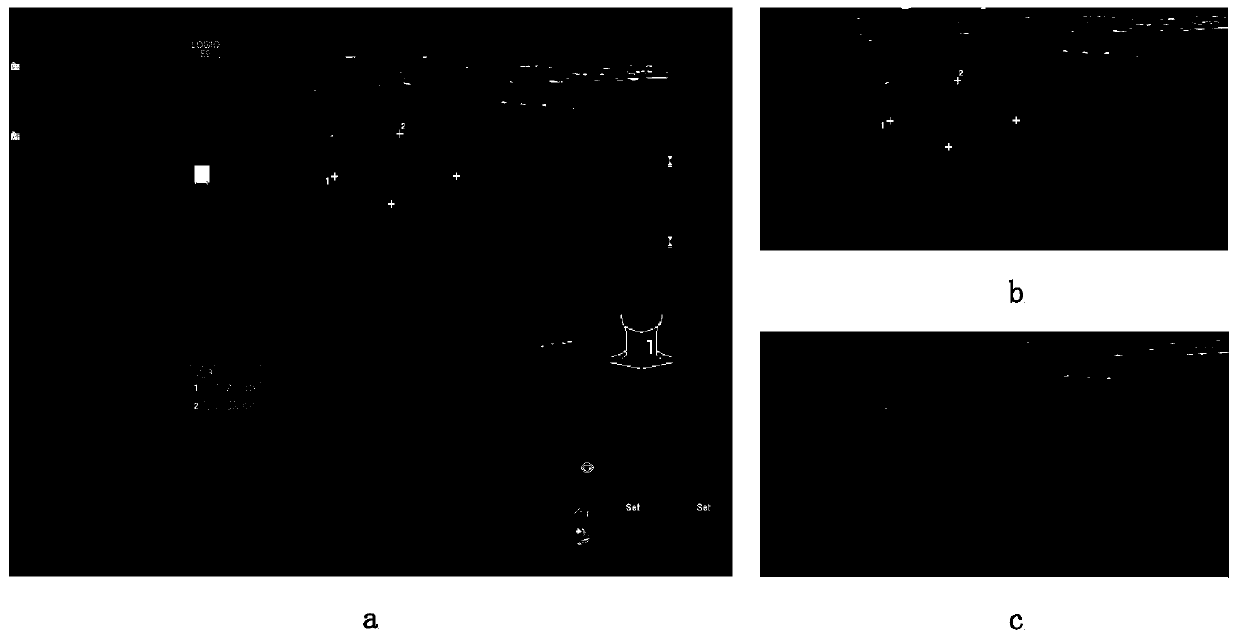 Thyroid ultrasound image nodule automatic positioning and identifying method based on USFaster R-CNN