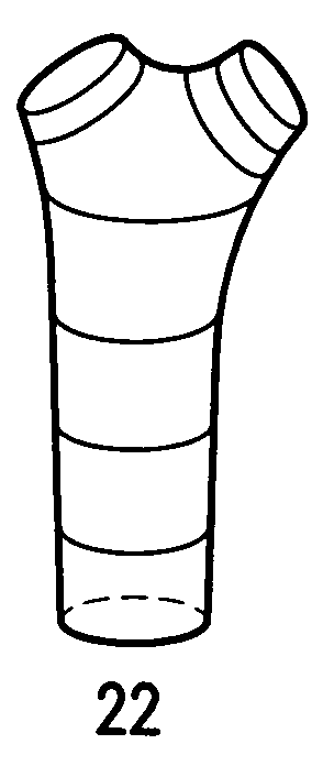 Biodegradable common bile duct stent and the method for preparing thereof