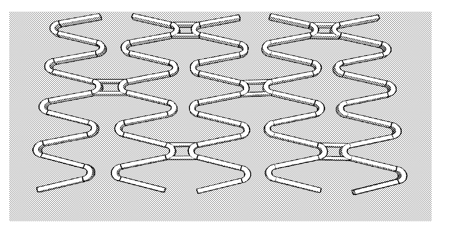 Matrix Coated Stent