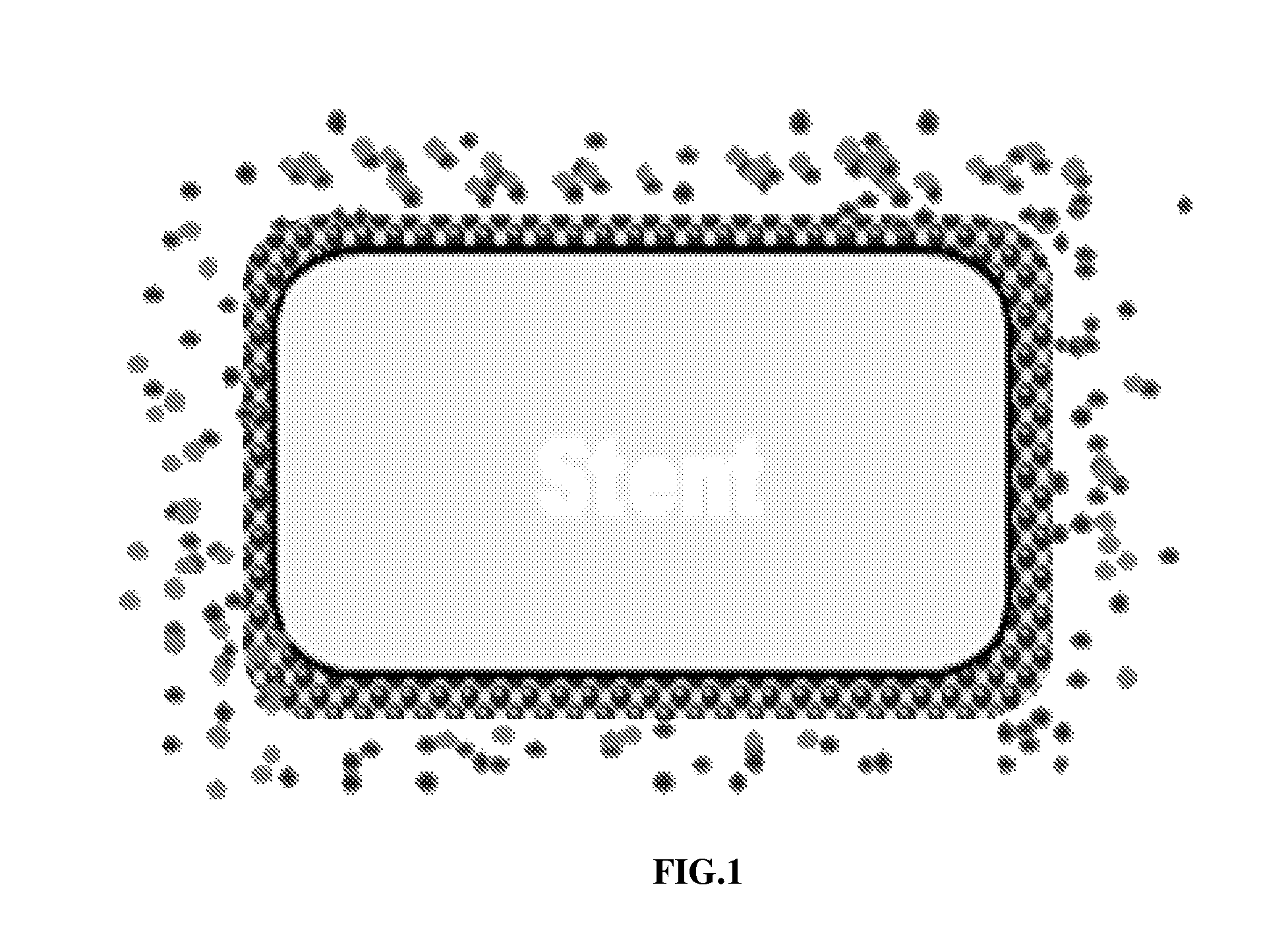 Matrix Coated Stent