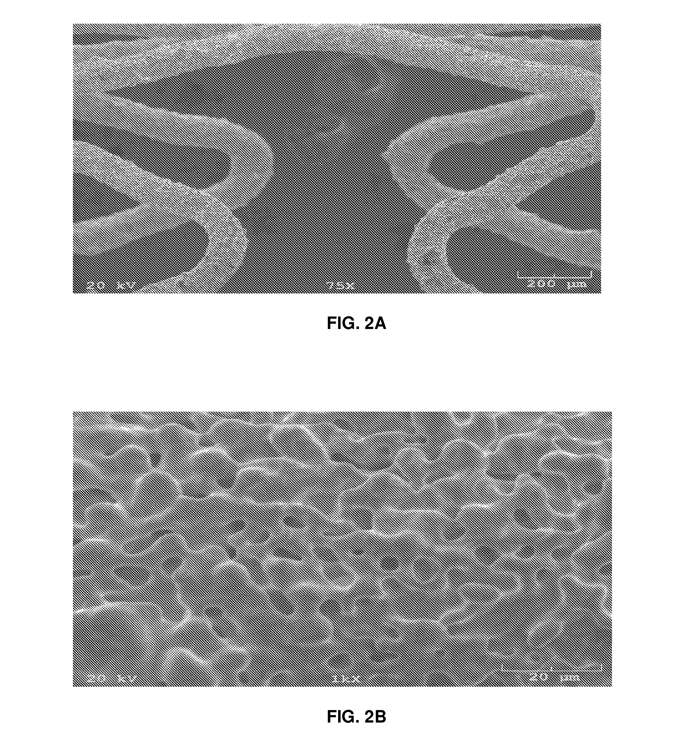 Matrix Coated Stent