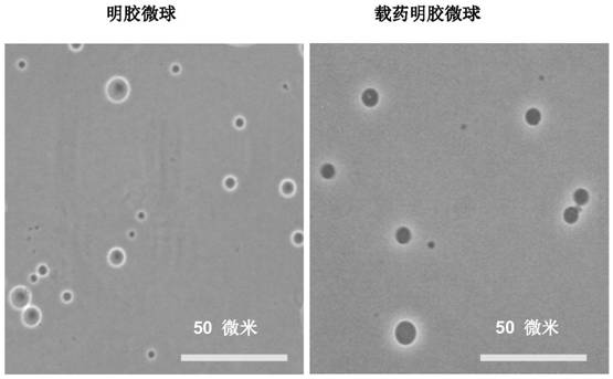 A drug-loaded hydrogel with dual responsiveness to enzyme and temperature and its preparation method and application