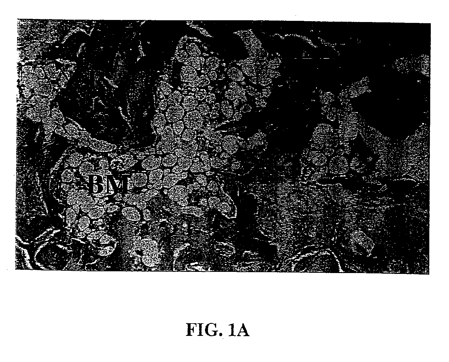 Tissue repair compositions and methods for their manufacture and use