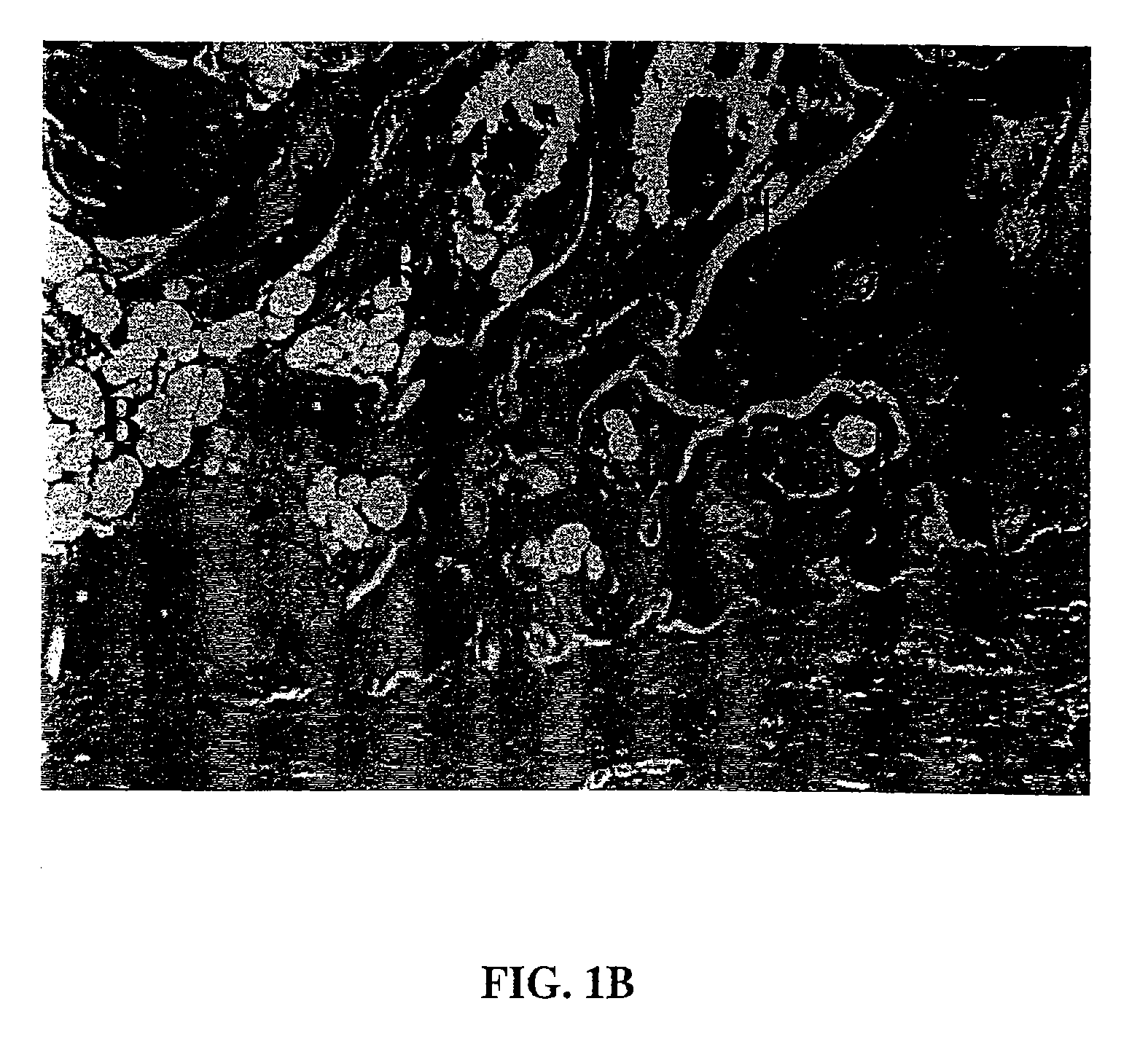 Tissue repair compositions and methods for their manufacture and use