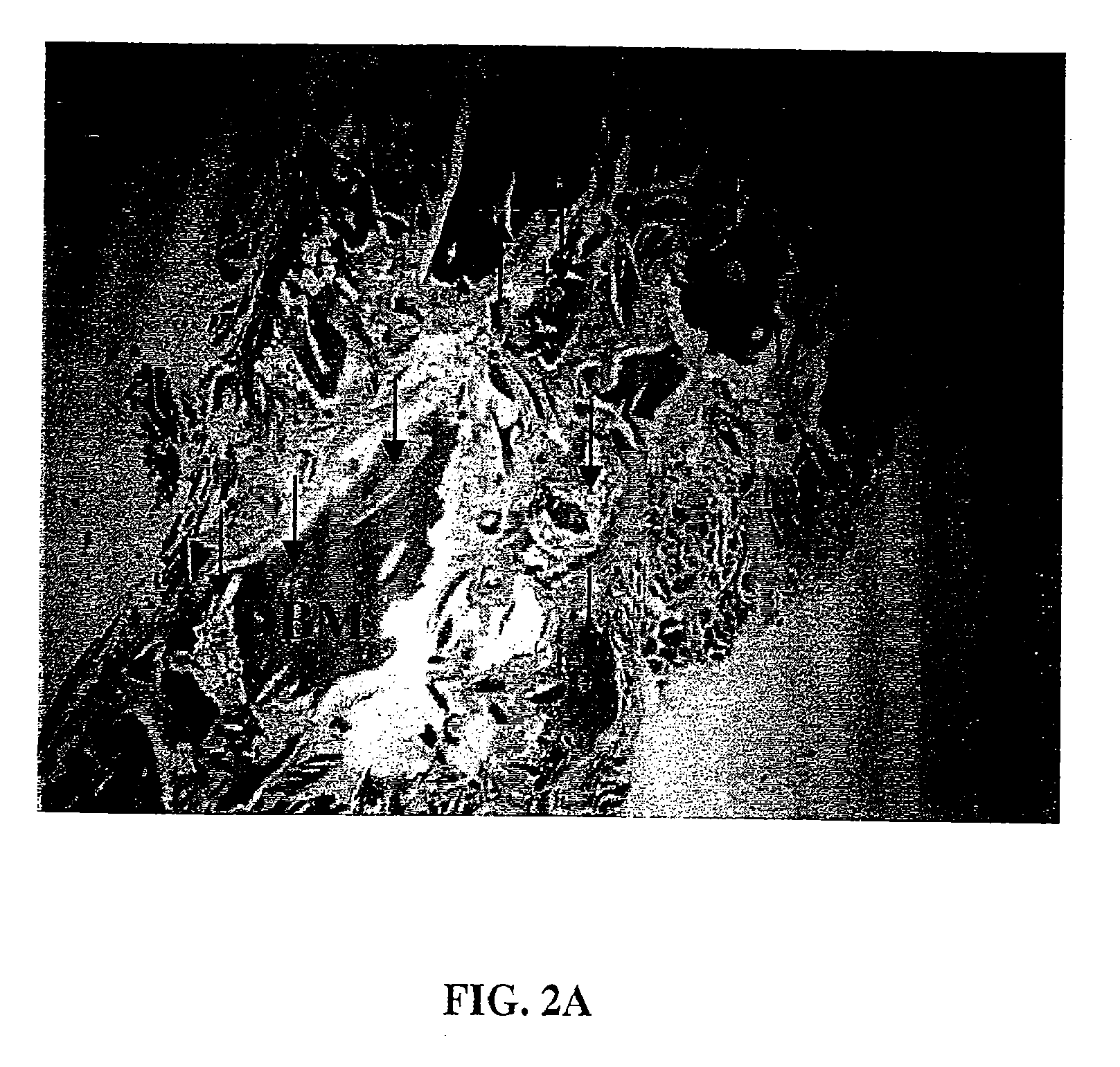 Tissue repair compositions and methods for their manufacture and use