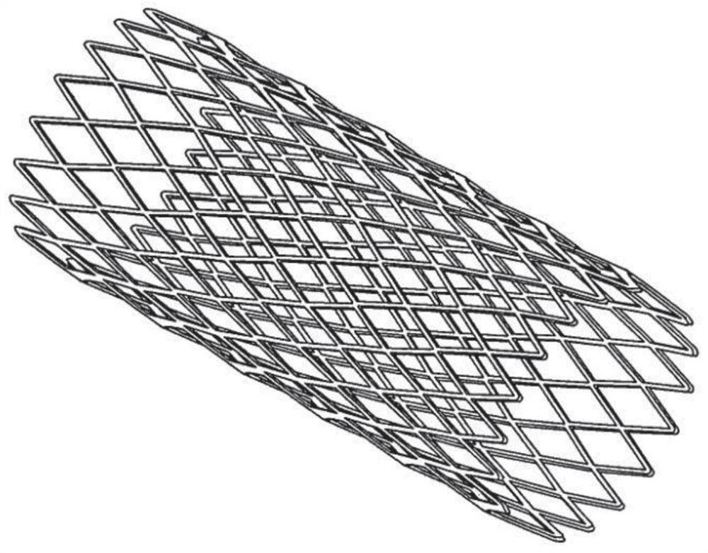 Nickel-titanium alloy preparation method for improving radial stability and medical device