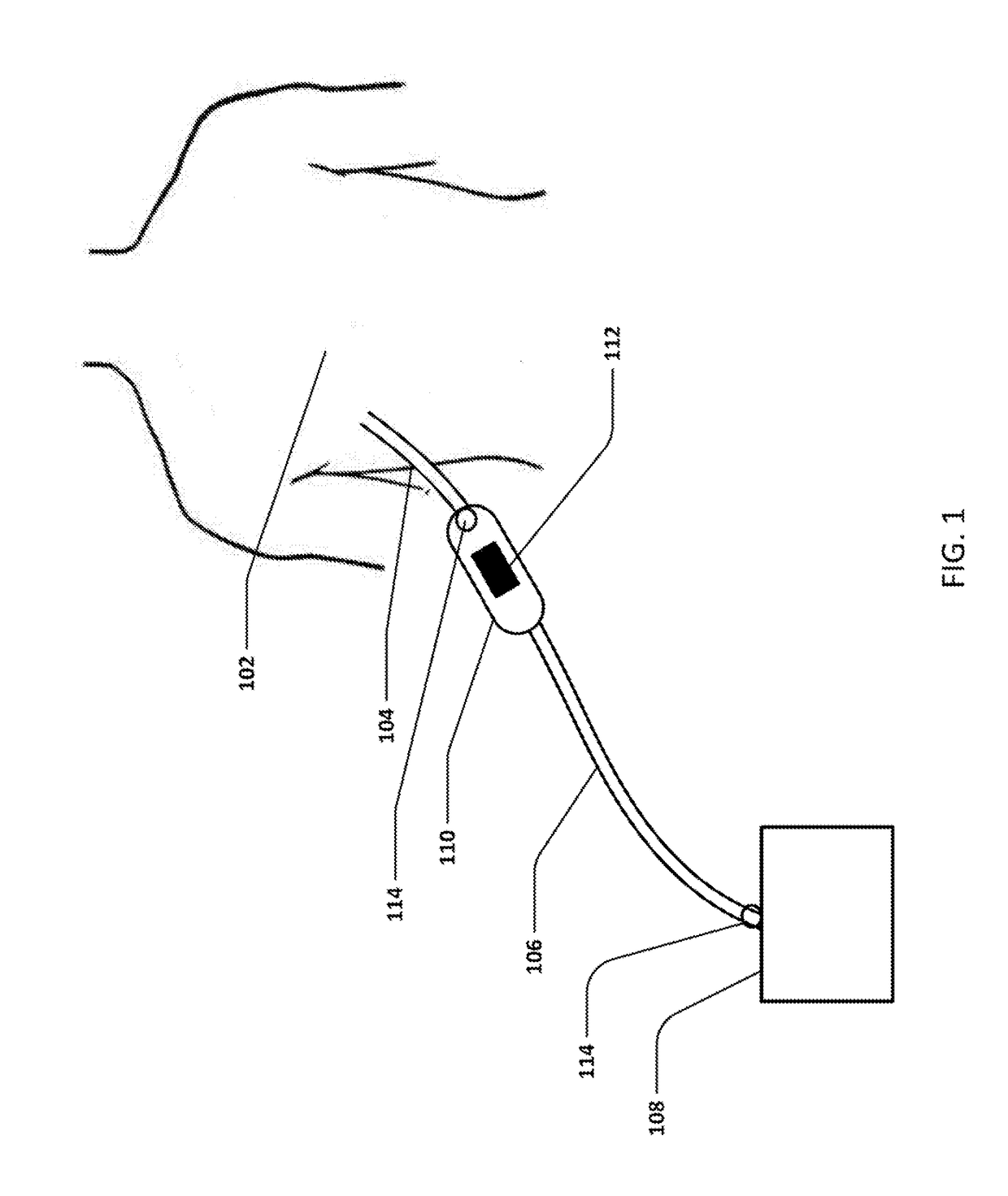 Devices and methods for managing chest drainage