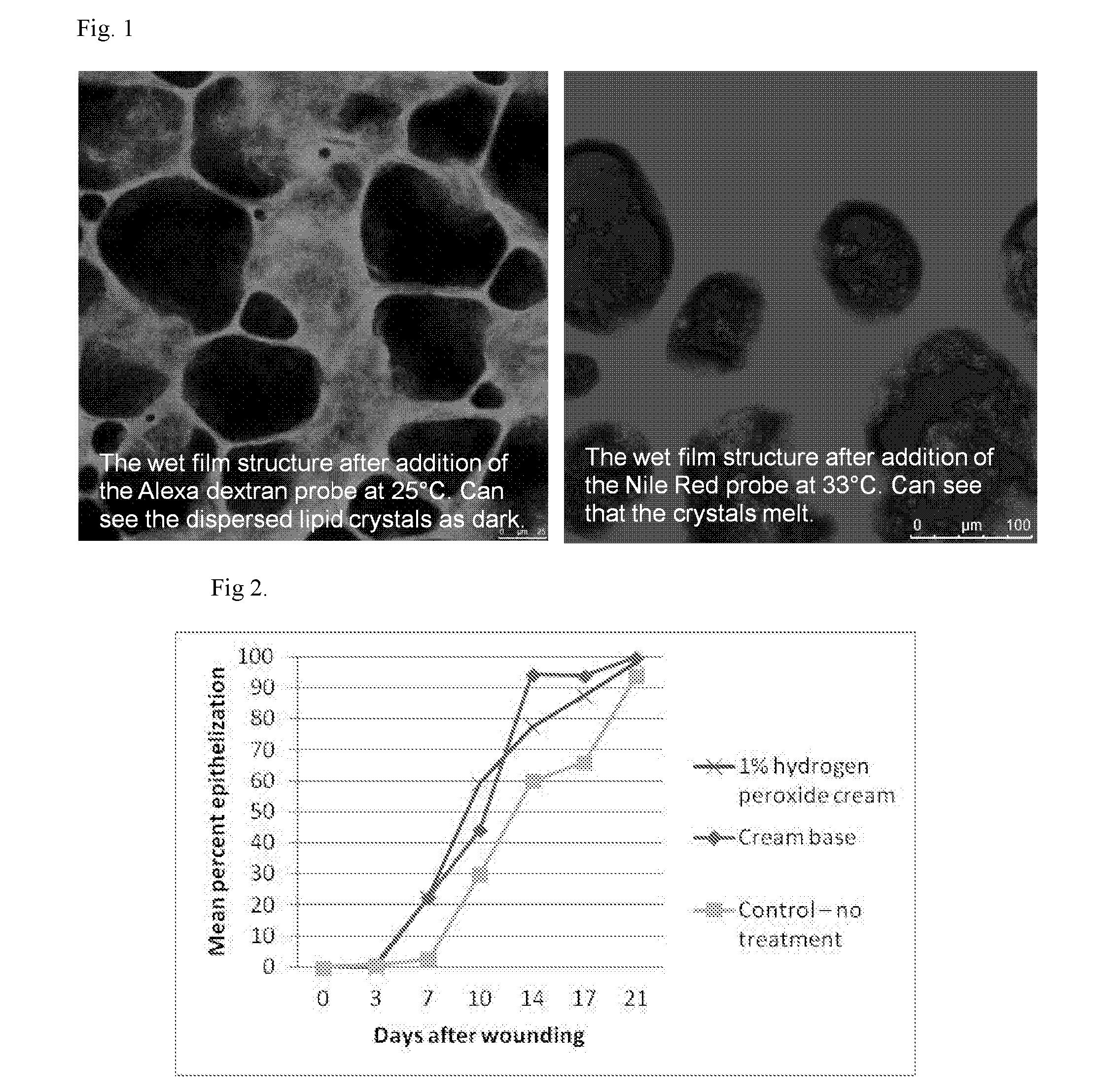 Composition for use in reducing scab formation and promoting healing