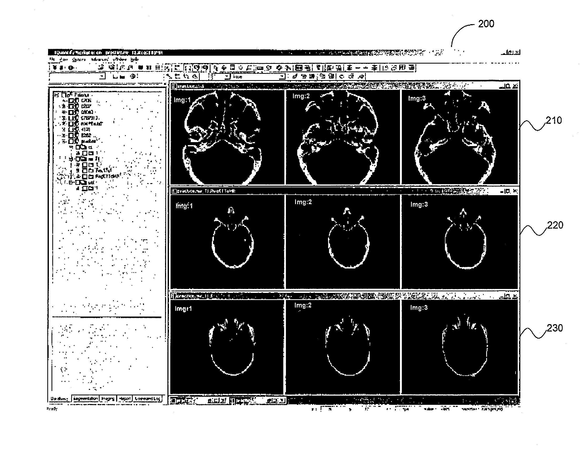 System and method for determining convergence of image set registration