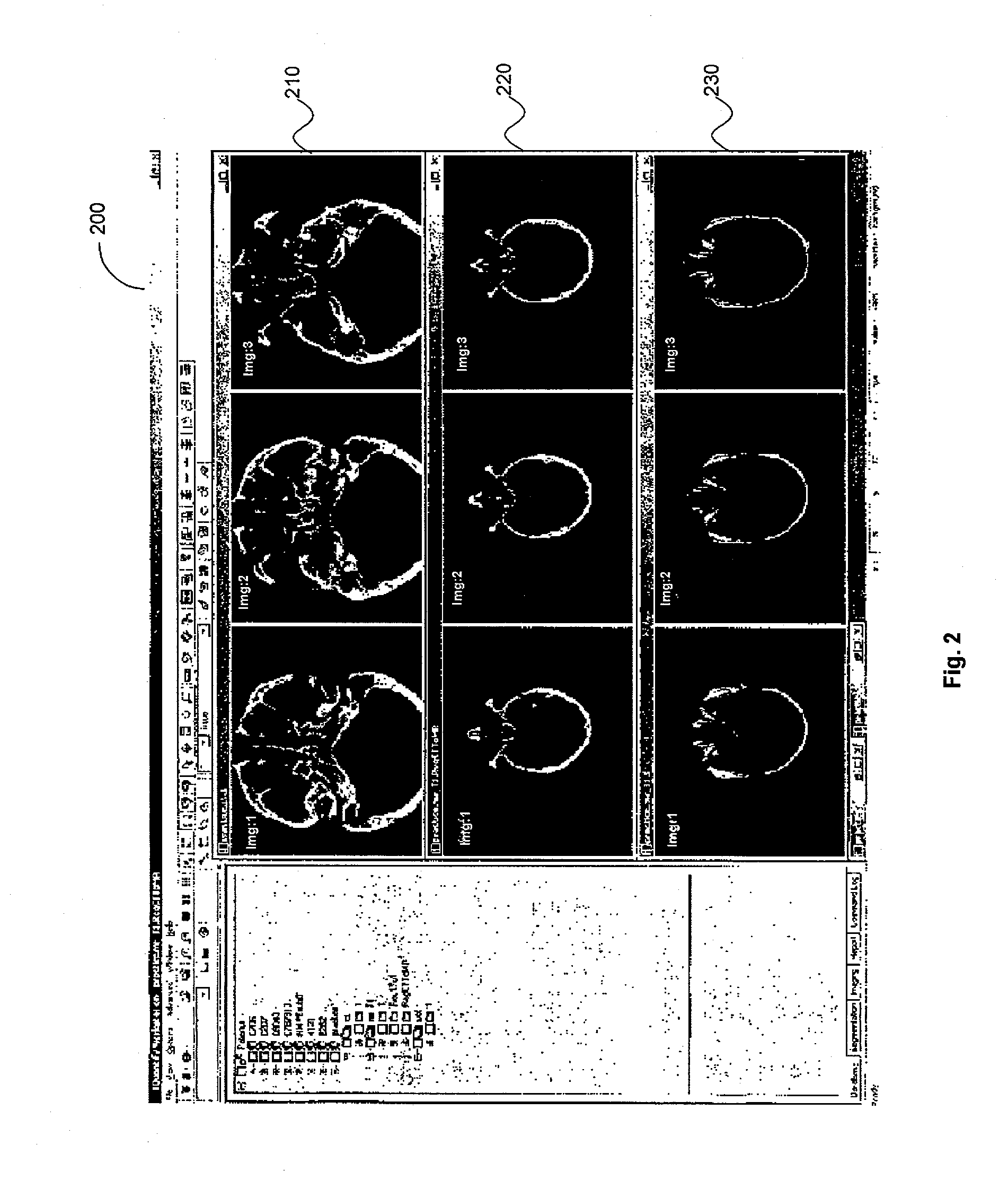 System and method for determining convergence of image set registration