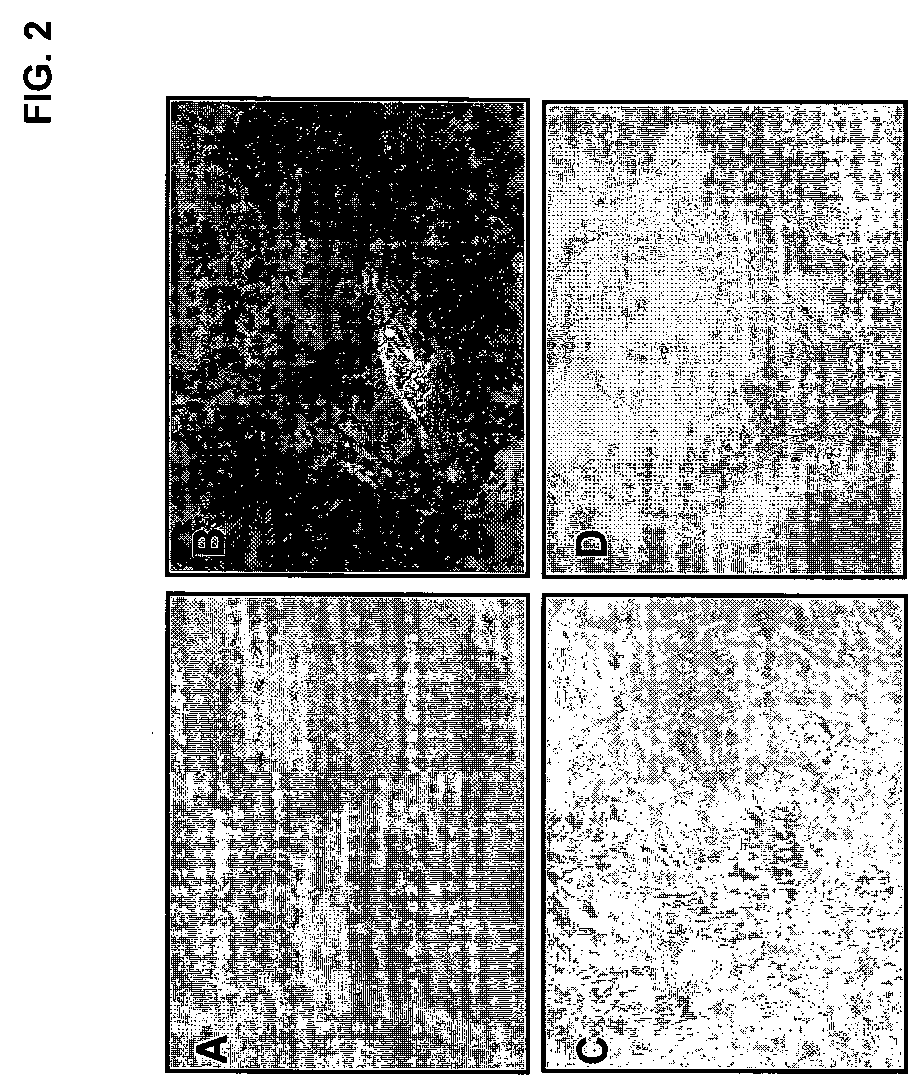 Isolation of multi-lineage stem cells