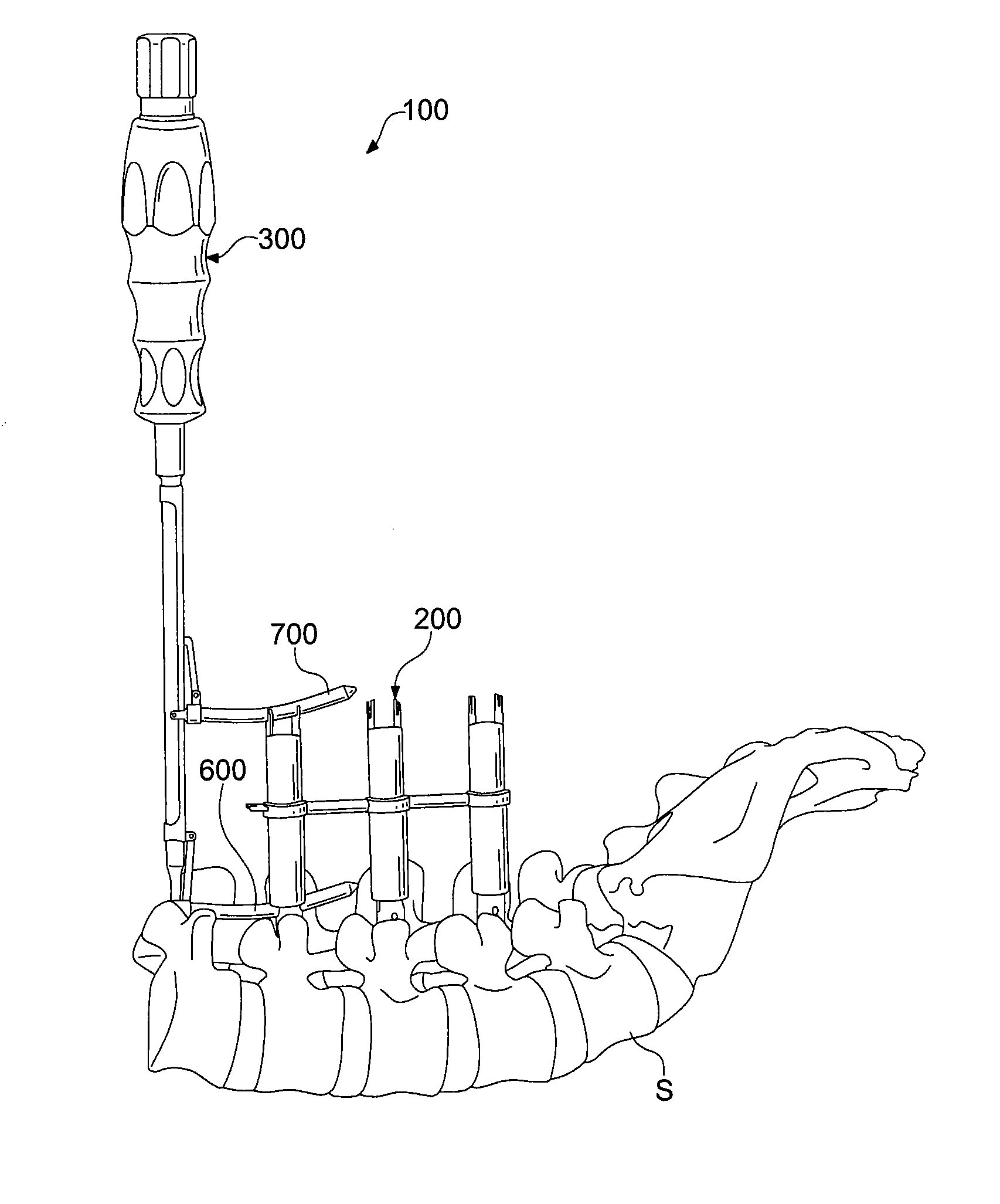 Percutaneous rod insertion system and method