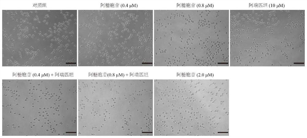 Aprepitant and cytarabine composition and an anti-leukemia effect thereof