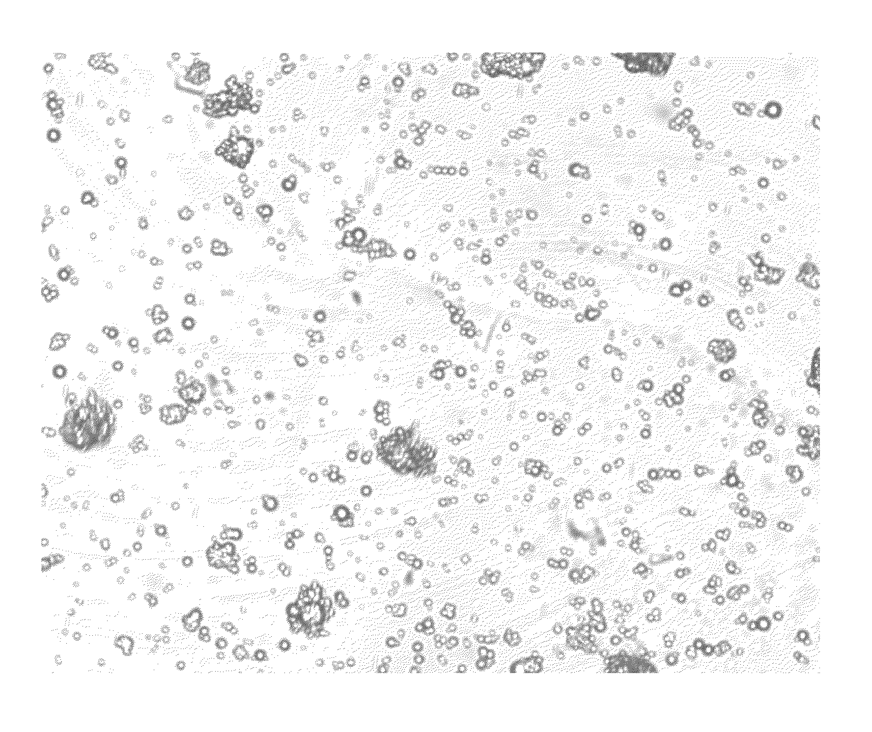 Pharmaceutical compositions comprising phosphate-binding polymer