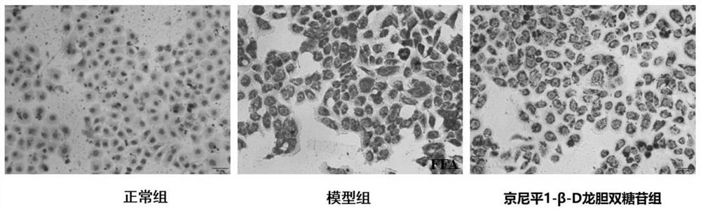 Medical application of iridoid glycoside compound