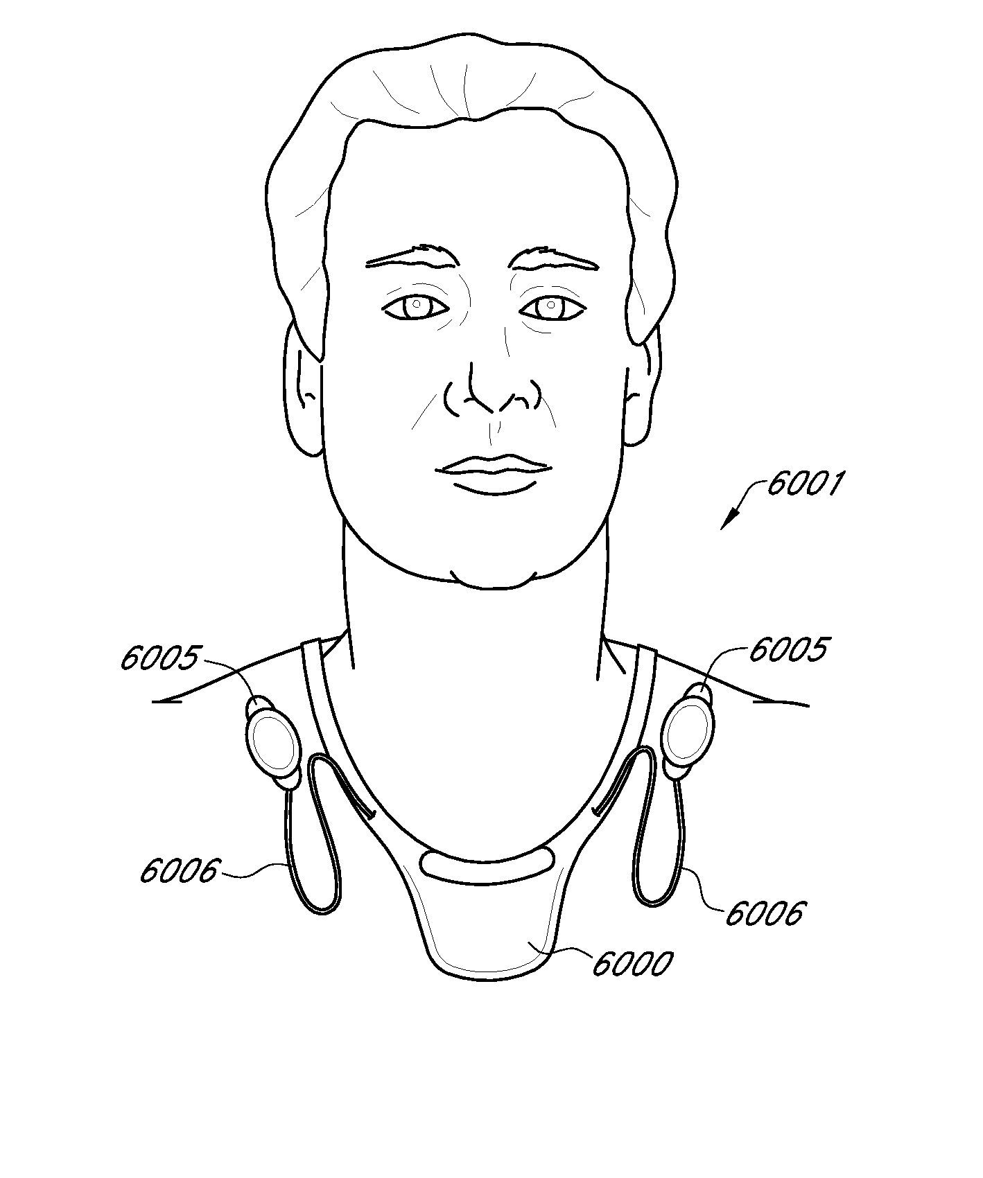 Methods and Devices for Treating Hypertension