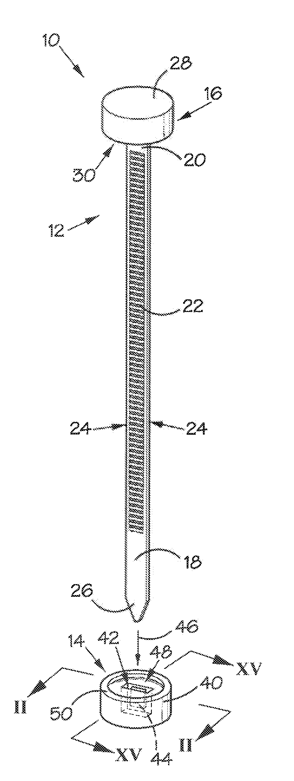 Fastening System