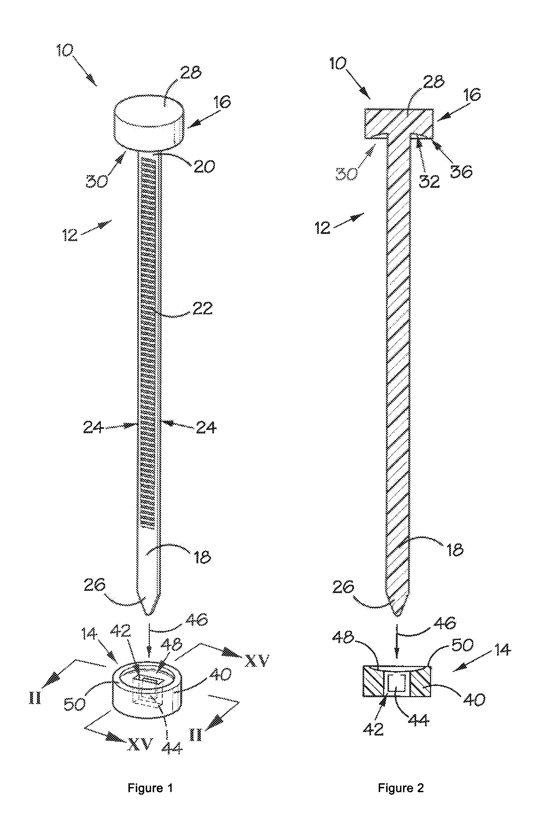 Fastening System