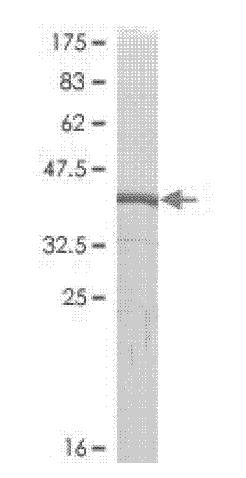 Chemiluminescence immunodetection kit and detection method for ovarian cancer tumor marker HE4