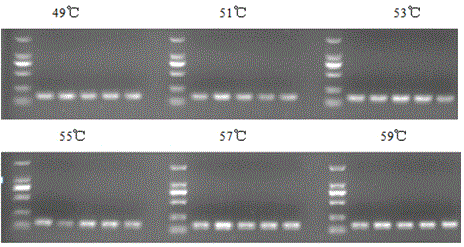 Application of specific genes of staphylococcus epidermidis