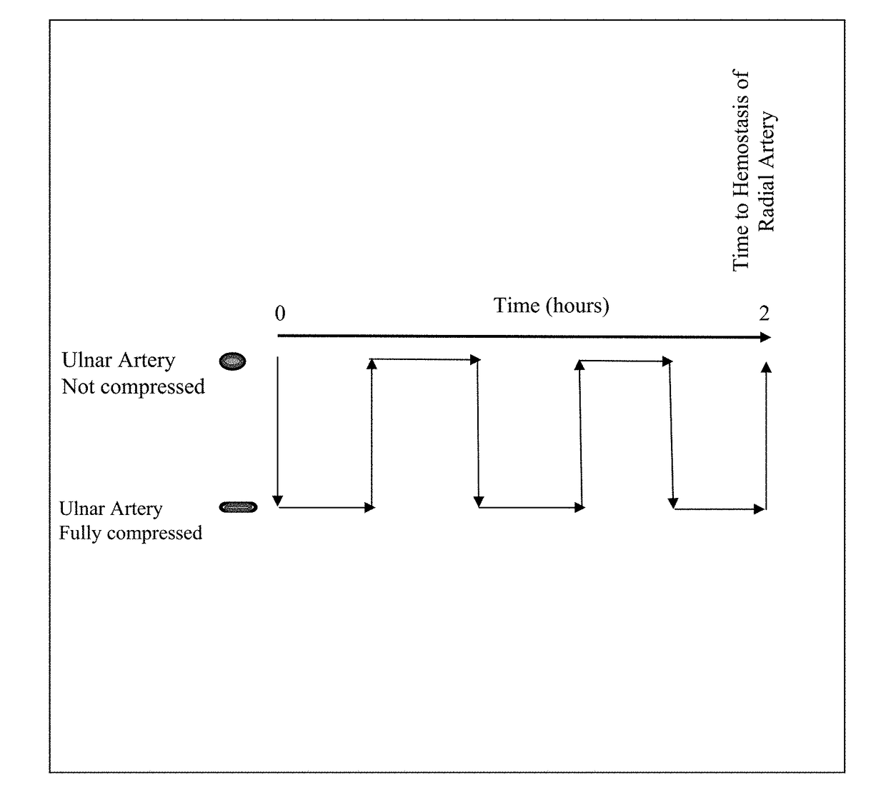 Method to stop bleeding, with short hemostasis duration using a low dose of anticoagulant