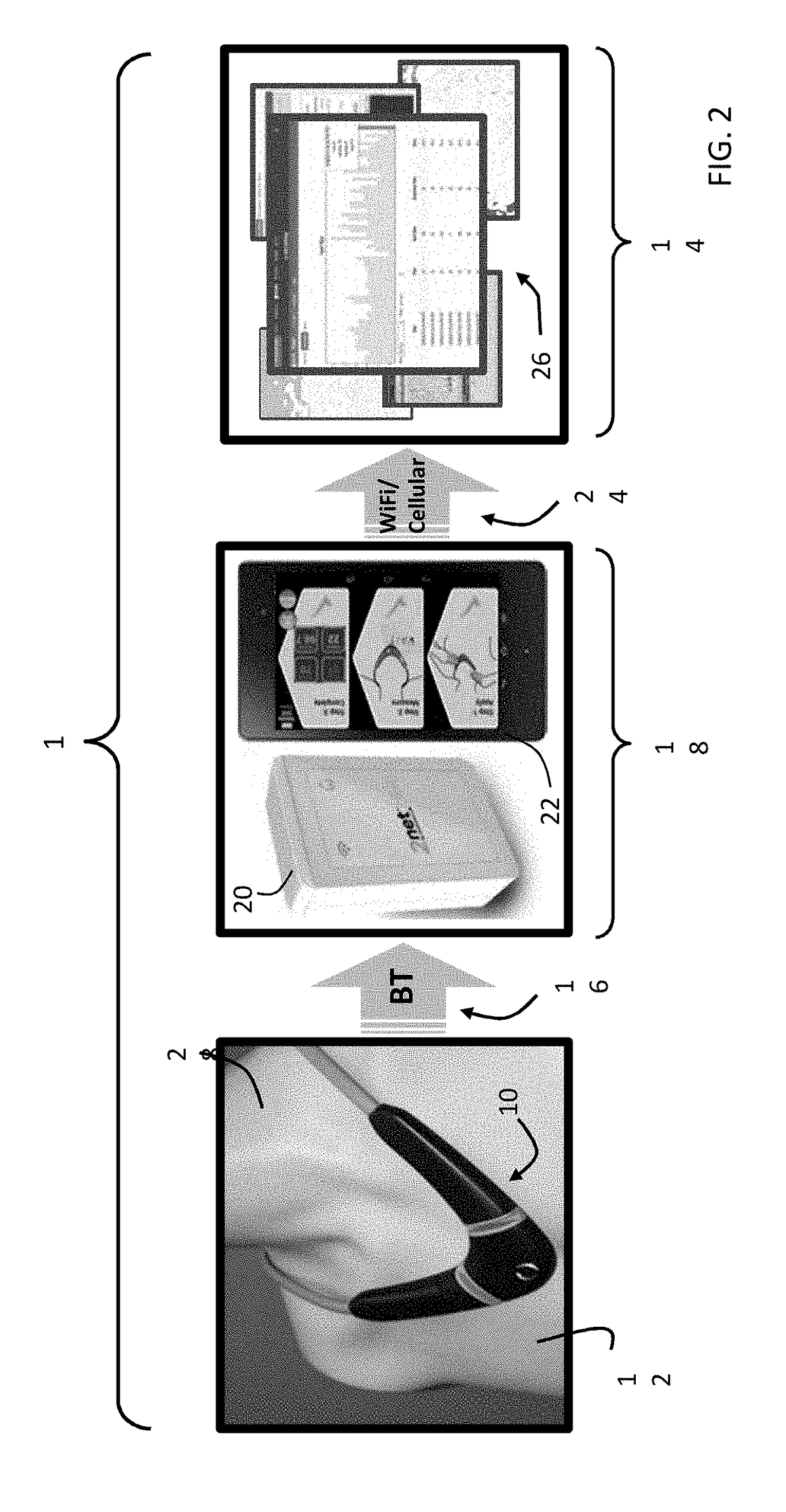 Neck-worn physiological monitor