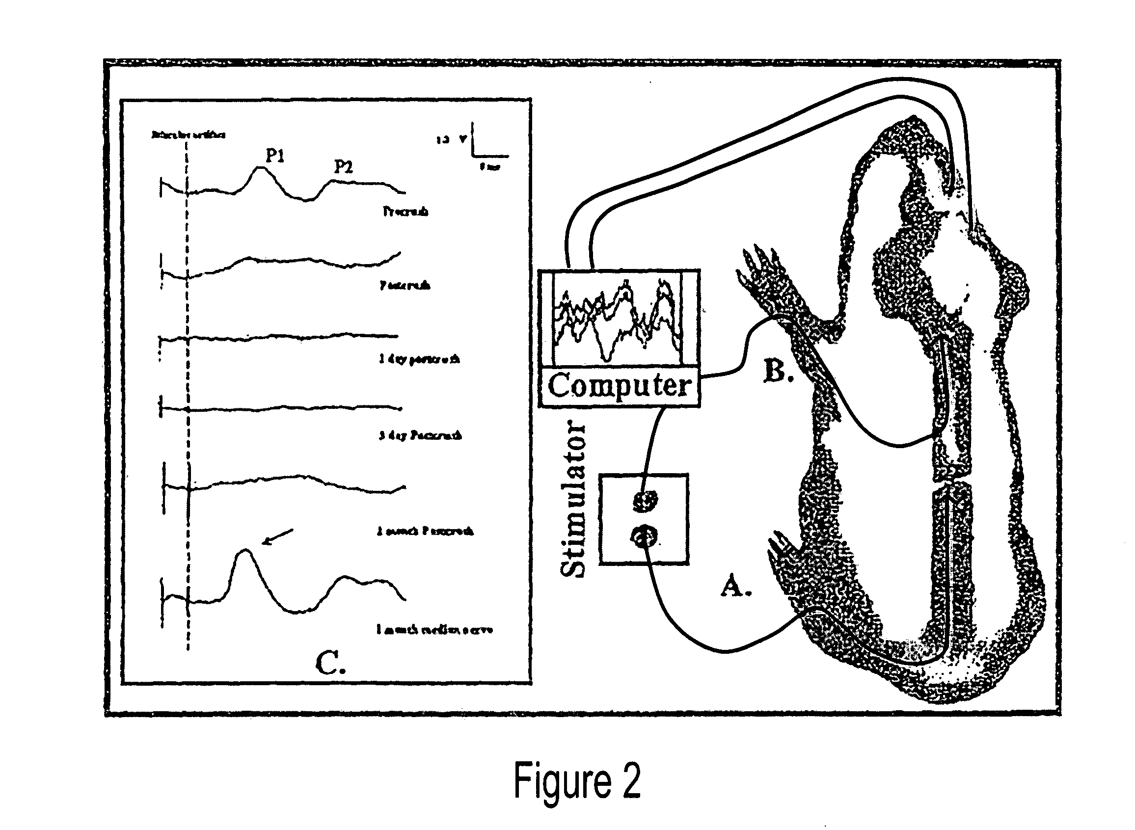 Pyridines for treating injured mammalian nerve tissue