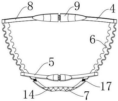 Multifunctional bracket for brain surgery in neurosurgery department