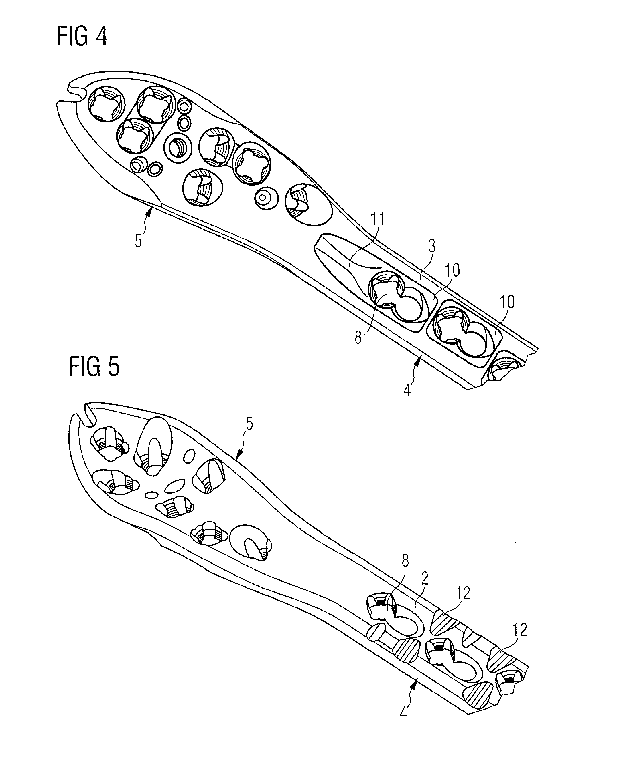 Bone Plate