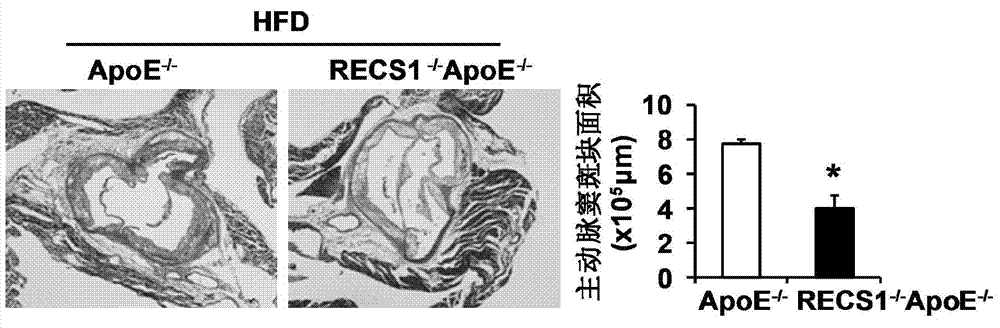 Function and application of blood shear stress responding protein 1 in treatment of atherosclerosis