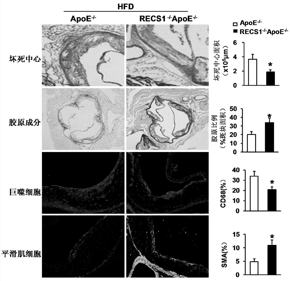 Function and application of blood shear stress responding protein 1 in treatment of atherosclerosis