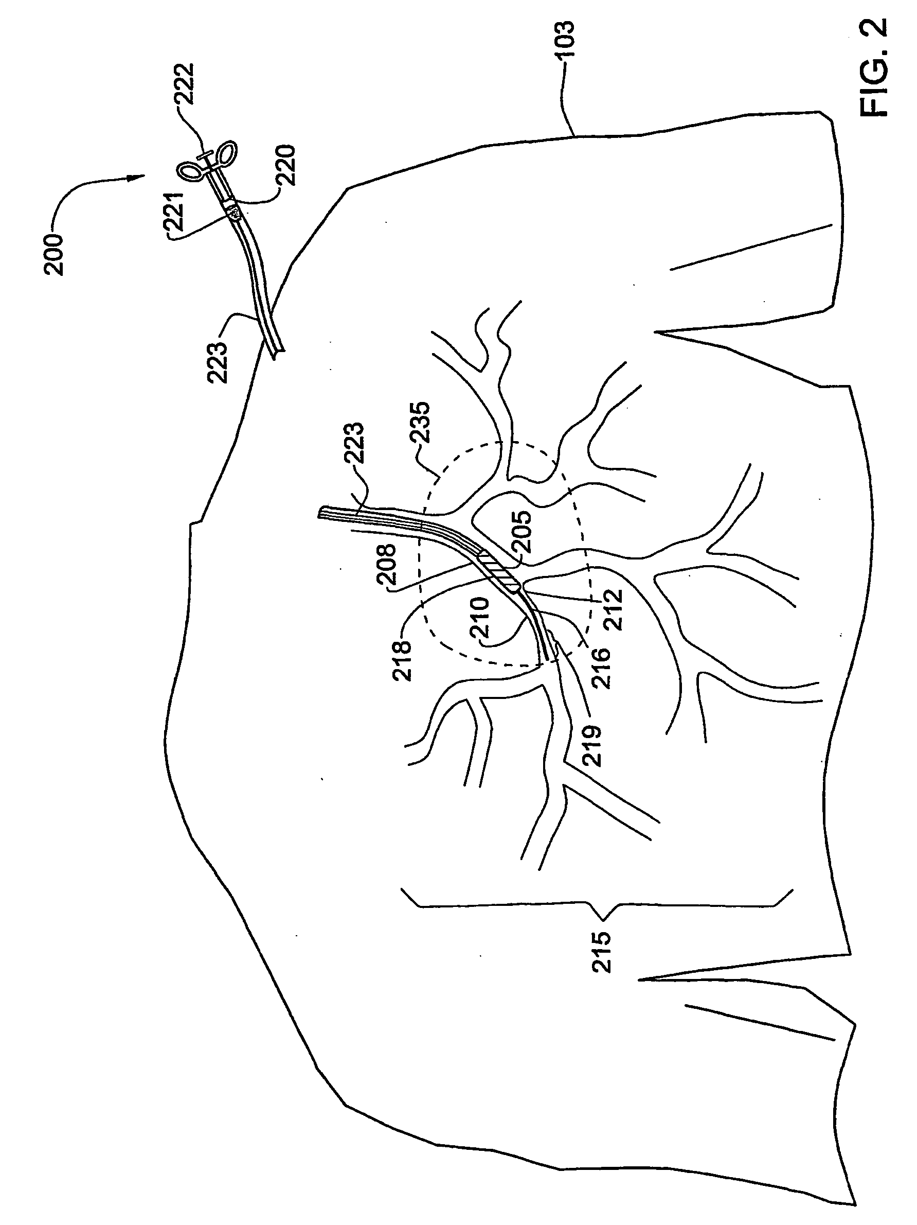 Method and system for positioning a device in a tubular organ