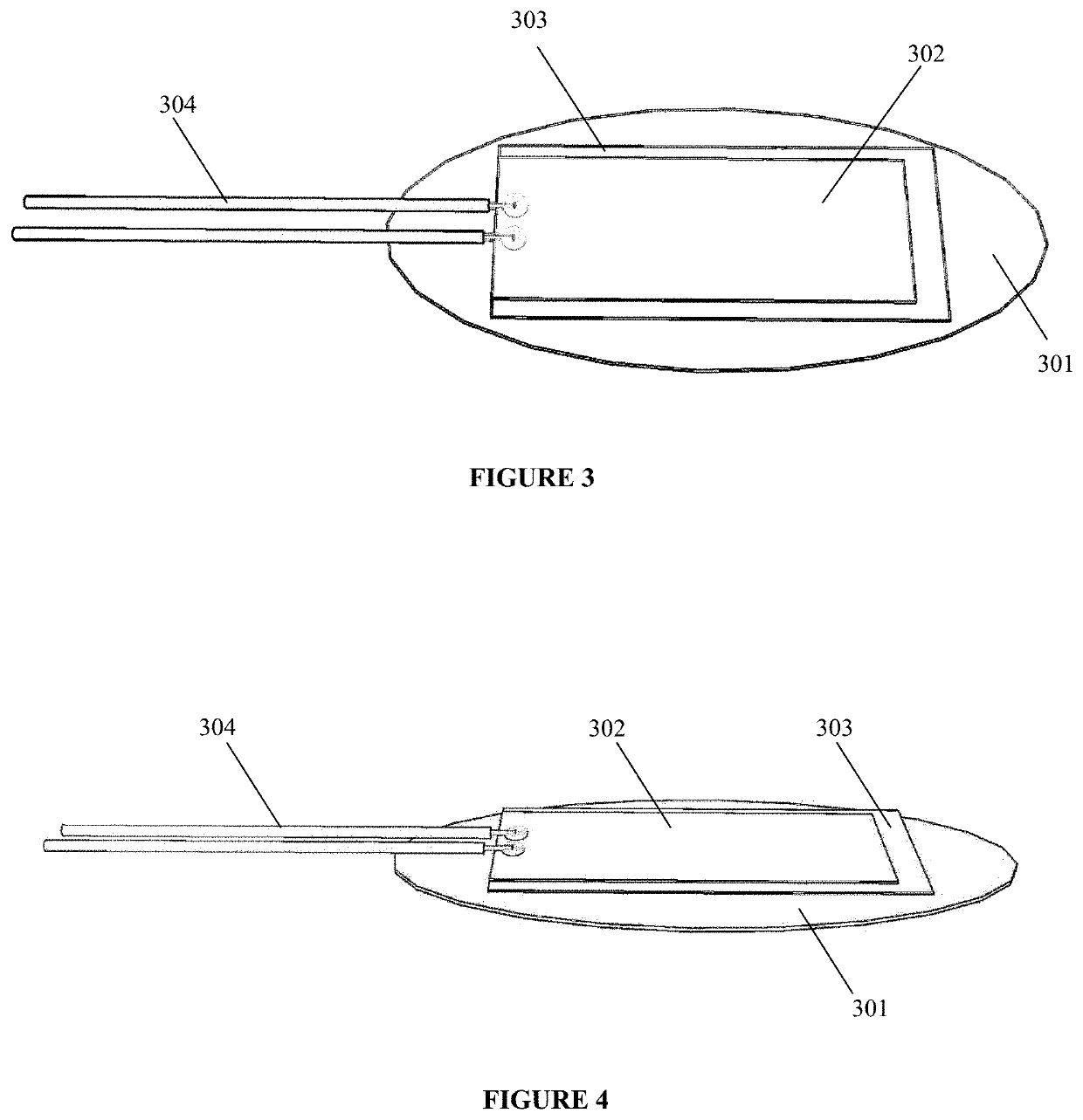 Sensor Apparatus for Measurement of Muscle Activity in the Detection & Treatment of Bruxism Disorder