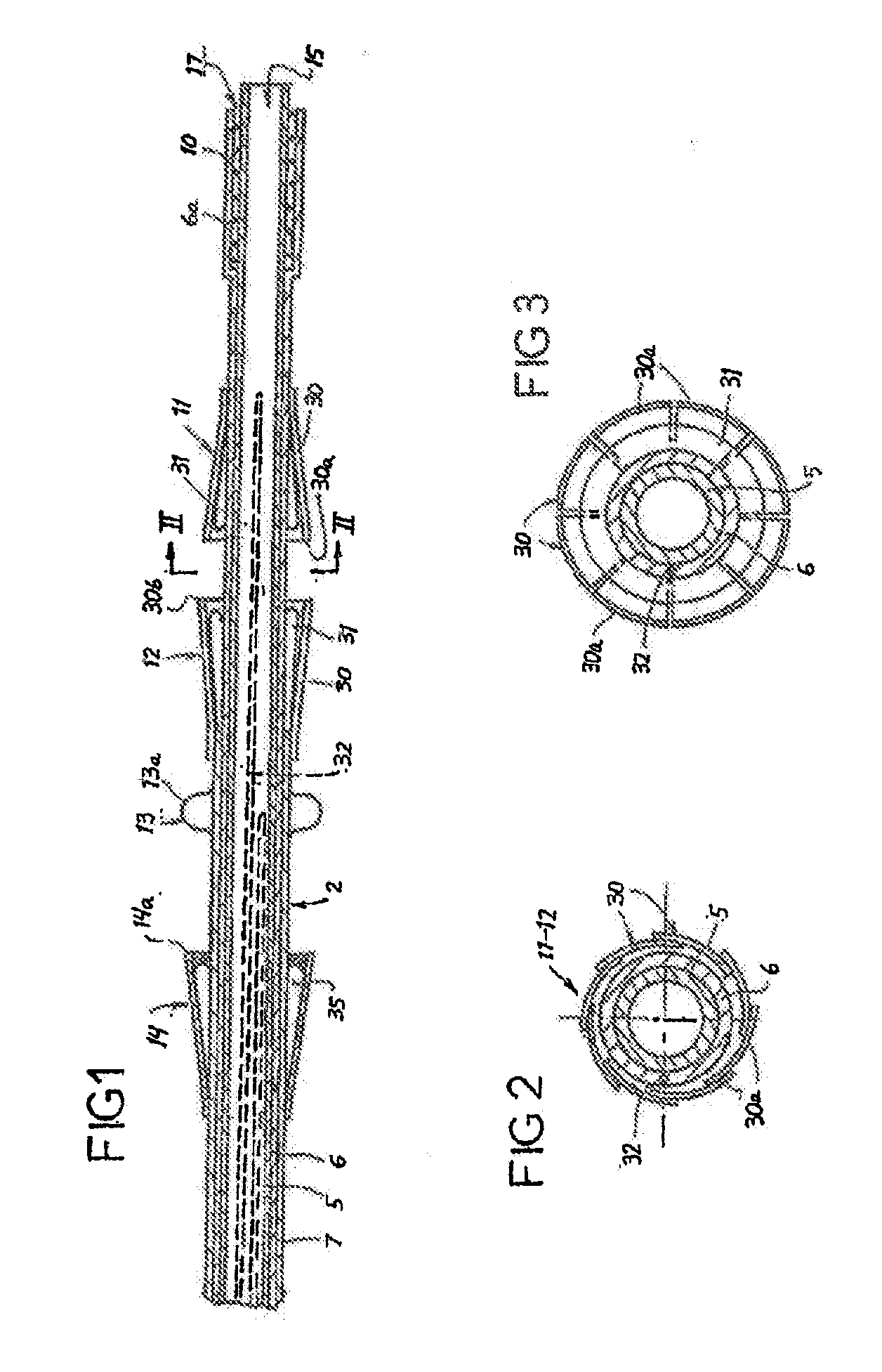 Prosthetic Valve for Transluminal Delivery